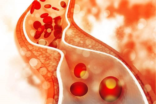 Blood cholesterol.
